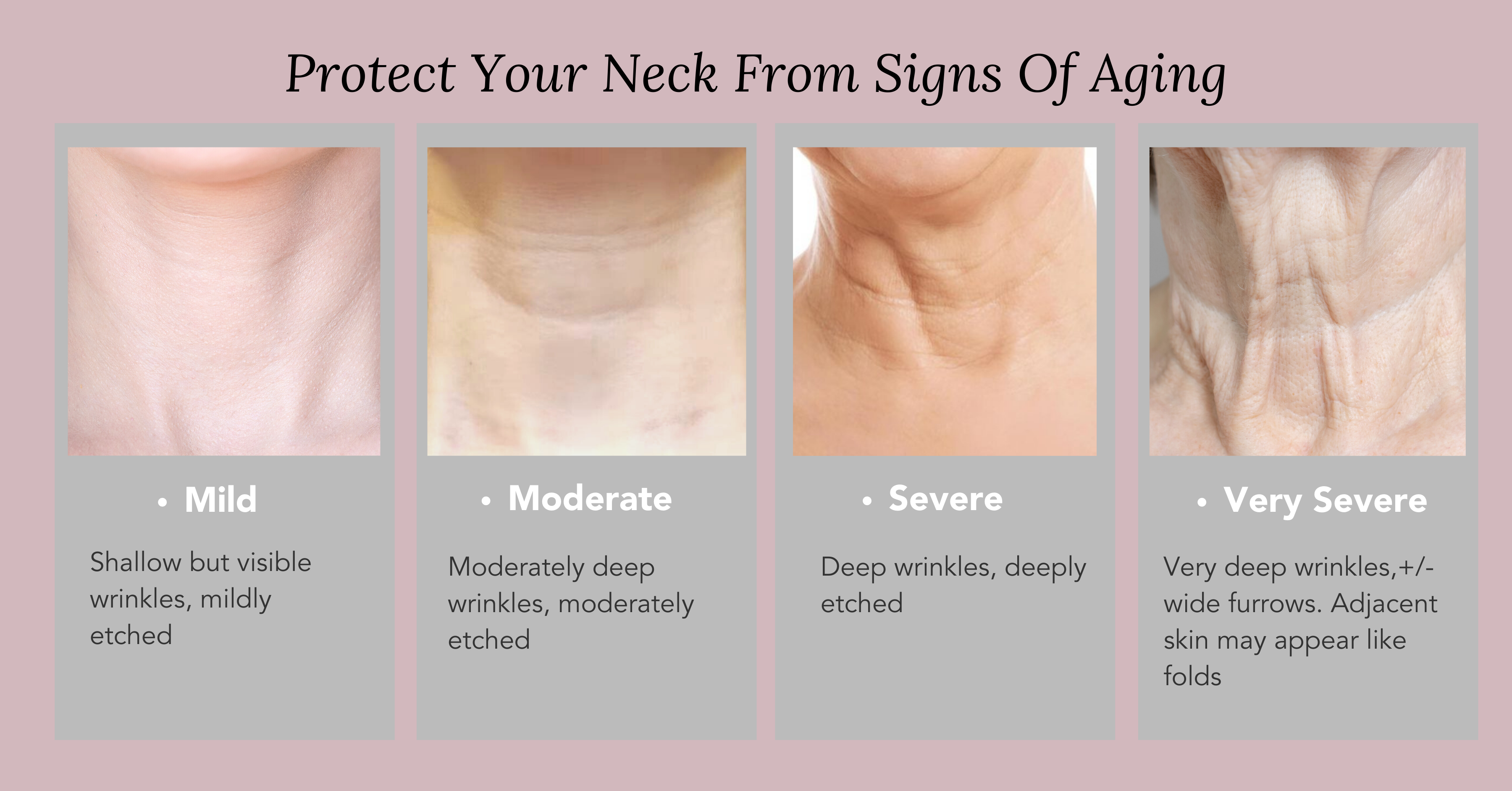 How To Treat, Reduce And Prevent Neck Wrinkles & Sagging